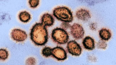 В России распространяется самый заразный штамм коронавируса за всю историю пандемии