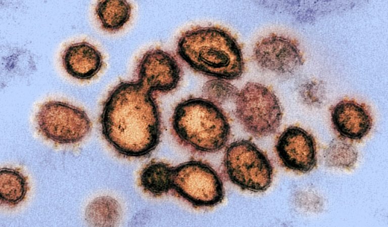 Изображение SARS-CoV-2, вируса, вызывающего заболевание COVID-19. Фото: NIAID-RML | Epoch Times Россия