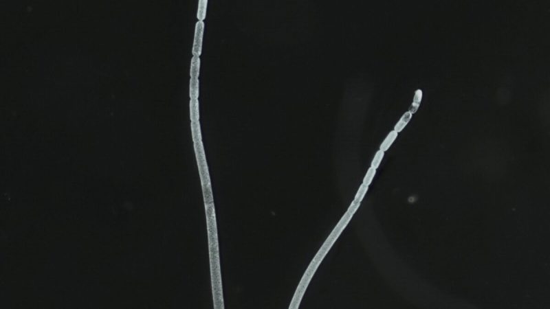 Нити бактерии Thiomargarita magnifica из Гваделупы, французского архипелага в Карибском бассейне, на недатированном раздаточном снимке. (Jean-Marie Volland/U.S. Department of Energy's Lawrence Berkeley National Laboratory/Handout via Reuters)  | Epoch Times Россия