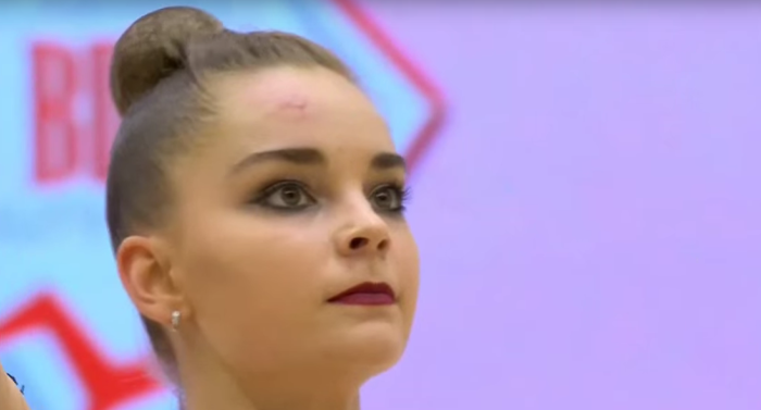 Серебряная призёрка «Токио-2020» Арина Аверина с турнира в Минске вернулась с шишкой на лбу