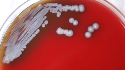 Бактерия, вызывающая редкое тропическое заболевание, обнаружена в почве и воде в США