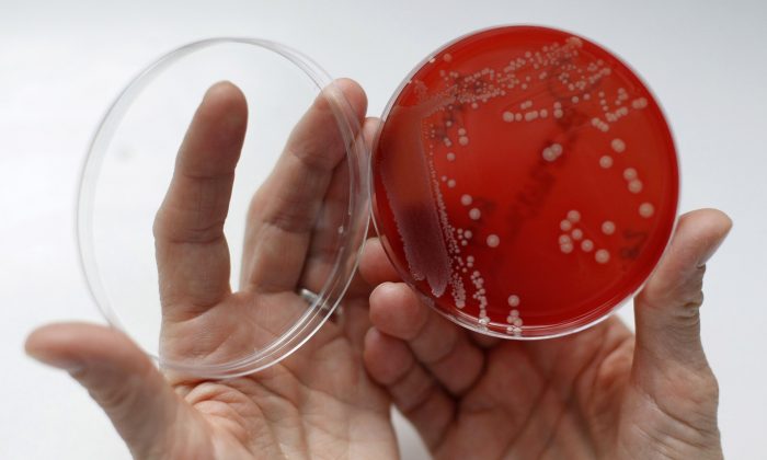 Штамм бактерий MRSA (Метициллинрезистентный золотистый стафилококк) в чашке Петри с агаровым желе. MRSA — это устойчивая к лекарствам «супербактерия», которая может вызывать смертельно опасные инфекции. (REUTERS/Fabrizio Bensch) | Epoch Times Россия