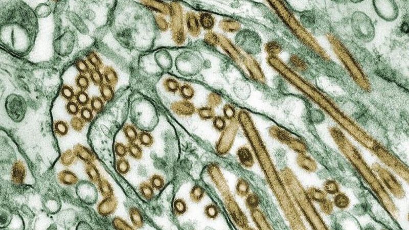 Вирусы птичьего гриппа A H5N1 (обозначены золотым цветом), выращенные в клетках MDCK (обозначены зелёным цветом). Фото: The Canadian Press/HO-CDC/Cynthia Goldsmith via NIH  | Epoch Times Россия