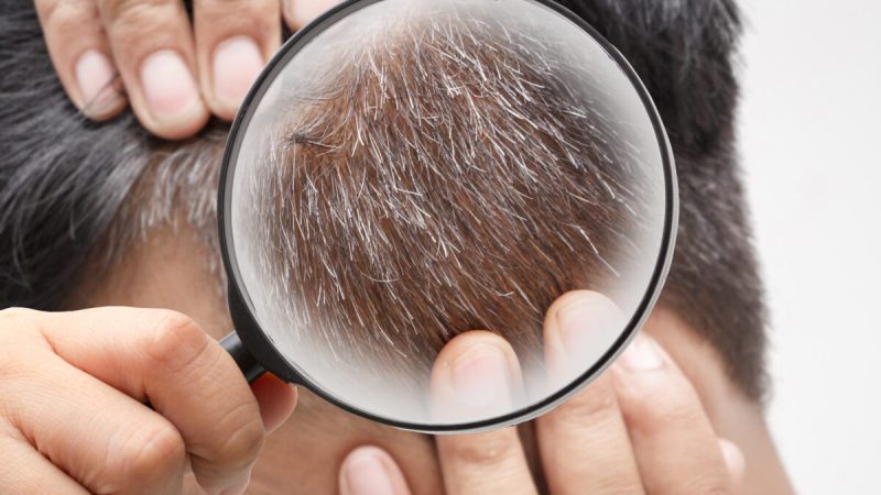 Исследователи смогли доказать, что как только волосы седеют, они не всегда остаются такими. (namtipStudio/Shutterstock)
 | Epoch Times Россия