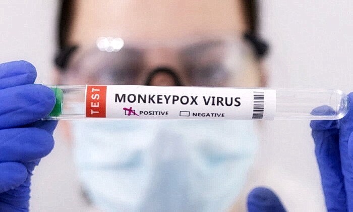 Пробирки с надписью «Вирус оспы обезьян положительный» на иллюстрации. (Dado Ruvic/Illustration/Reuters)
 | Epoch Times Россия