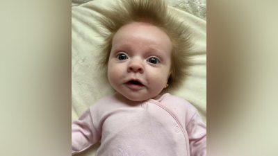 Ребёнок родился с волосами, которые торчат во все стороны