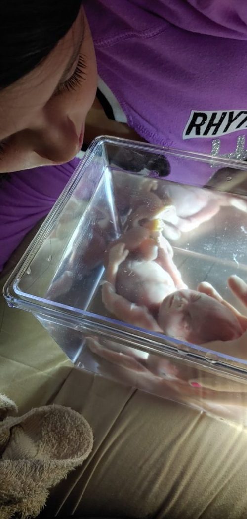 Подводные фотографии позволили скорбящей маме увидеть 18-недельного ребёнка после выкидыша с удивительной чёткостью