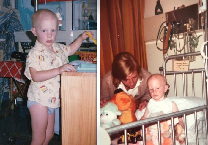 Австралиец выжил после экспериментального лечения рака: Это сожгло меня изнутри и снаружи