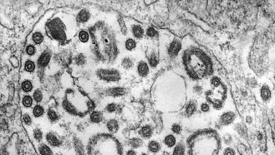 CDC предупреждает врачей о смертельно опасном вирусе, похожем на Эболу
