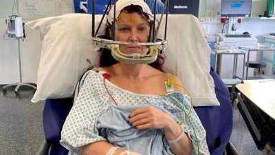 Женщине в 44 года диагностировали болезнь Паркинсона, но первые симптомы она заметила в 26 лет