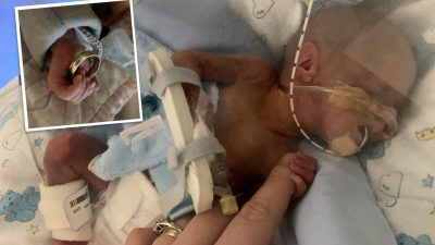 Малыш родился слишком рано, чтобы выжить… Теперь ему два года, и он любимец большой семьи