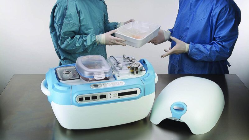 LifePort Kidney Transporter, автоматизированное устройство для оценки и транспортировки почек для трансплантации, показано на этой недатированной рекламной фотографии. (LifePort/Getty Images)
