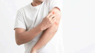 Эффективные советы из традиционной китайской медицины для страдающих дерматитами