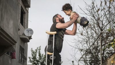 Потрясающая фотография сирийских беженцев — одноногого отца и его маленького сына без рук и ног, помогла изменить их жизнь