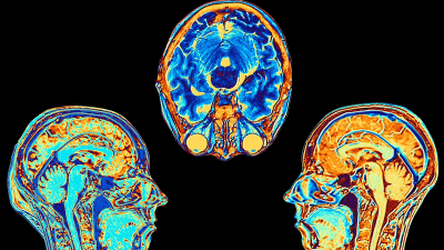 Бдительное ожидание — так можно назвать новое направление лечения рака