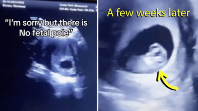 Женщина доверилась своей интуиции, и ошибочный диагноз врача не привёл к трагедии