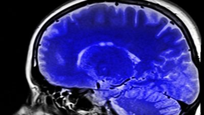 Эндокринолог рекомендует дыхательную гимнастику от деменции