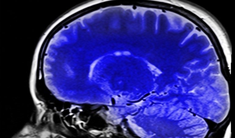  Фото: (pxhere.com/СС0) | Epoch Times Россия