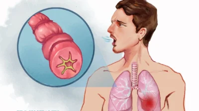 Основное руководство по астме: симптомы, причины, лечение и естественные подходы