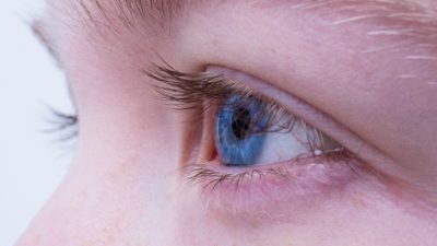 В Ставропольском крае женщина две недели ходила с инородным предметом в глазу.