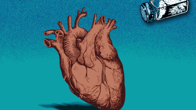 Дефицит соли может быть опасен для жизни. Вот менее известные опасности