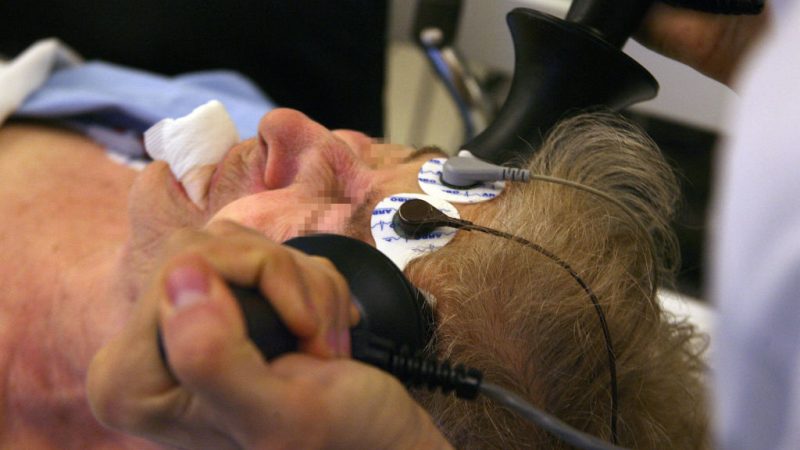 электрошок