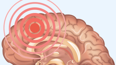 Основное руководство по тревожным расстройствам: симптомы, причины, лечение и естественные подходы