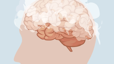 Мозговой туман: симптомы, причины, лечение и естественные подходы