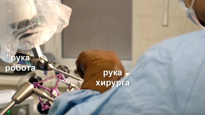 Впервые робот-хирург провёл уникальную операцию в Нижнем Новгороде Фото: t.me/presseco | Epoch Times Россия