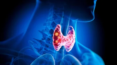 Заболевания щитовидной железы: натуральные средства и варианты лечения