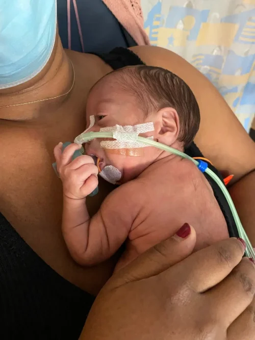 Оззи находился в отделении интенсивной терапии первые три месяца своей жизни. (Courtesy of Suzy Mack) Маме посоветовали сделать аборт по медицинским показаниям, но она выбрала жизнь