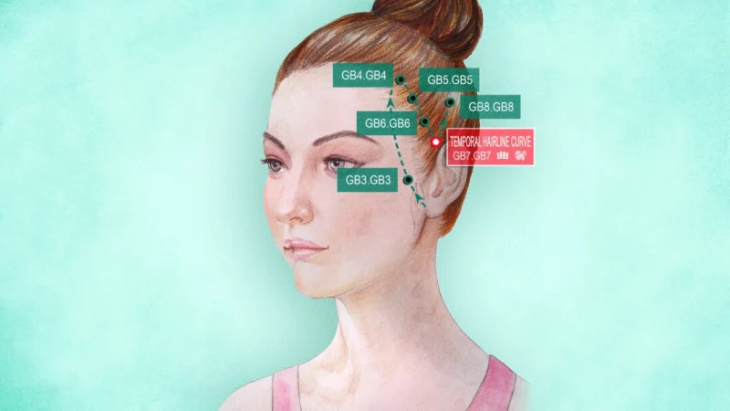 Цюй Бинь Височная линия роста волос GB7 (The Epoch Times) | Epoch Times Россия