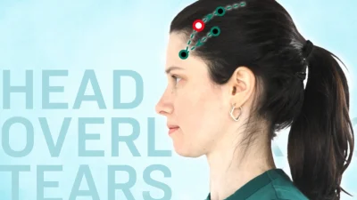 Акупунктура Хуань Тяо помогает тазобедренным суставам оставаться сильными