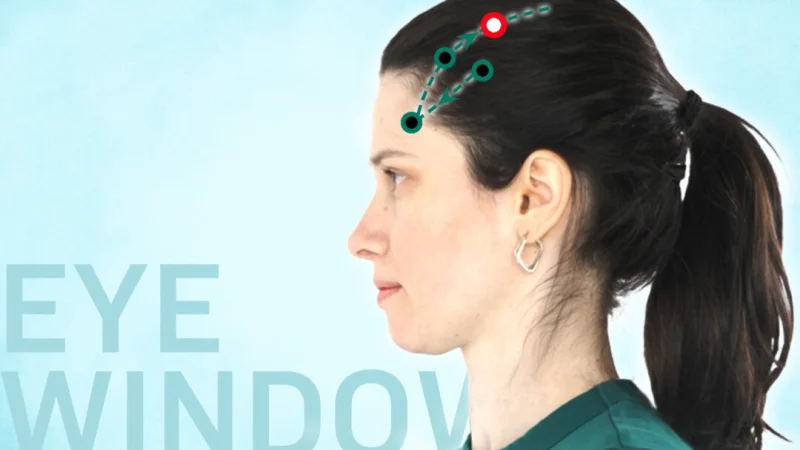 Му Чуан, Окно глаза GB16 (The Epoch Times) | Epoch Times Россия