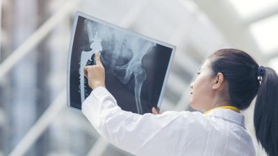 Здоровье костей: 4 натуральных продукта, богатых кальцием