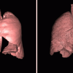 Как защитить лёгкие от горя: рецепт «нефритового экрана»