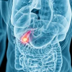 Всегда ли необходимо удаление жёлчного пузыря?