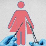 Эксперты: Вердикт по делу о трансгендерной* хирургии на $2 млн стал поворотным моментом