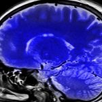 В России разработали тест-системы для ранней диагностики болезни Альцгеймера