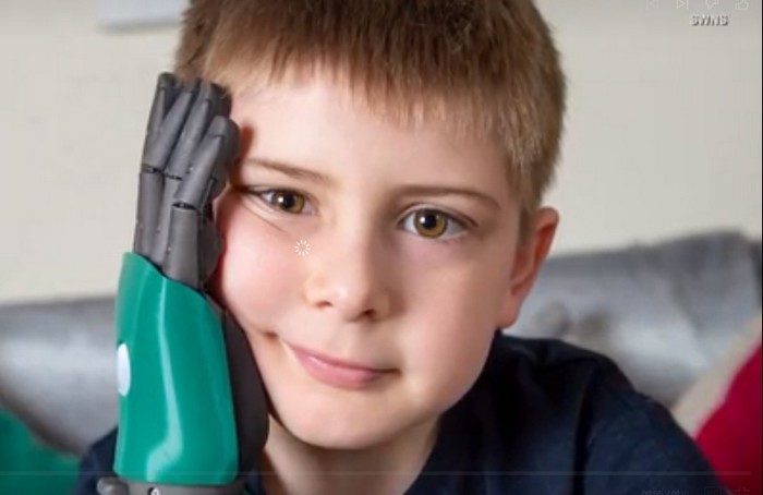 8-летний мальчик стал самым молодым обладателем бионической руки и исполнил свою мечту — держать гамбургер двумя руками!