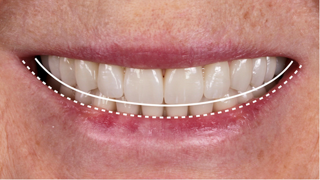 10 главных признаков идеальной улыбки, по мнению стоматолога
